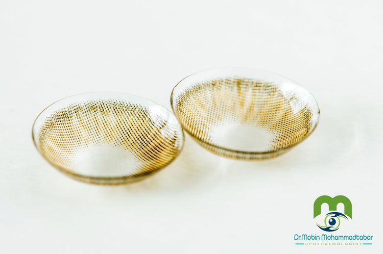 مزایای لنز طبی