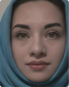 بلفاروپلاستی