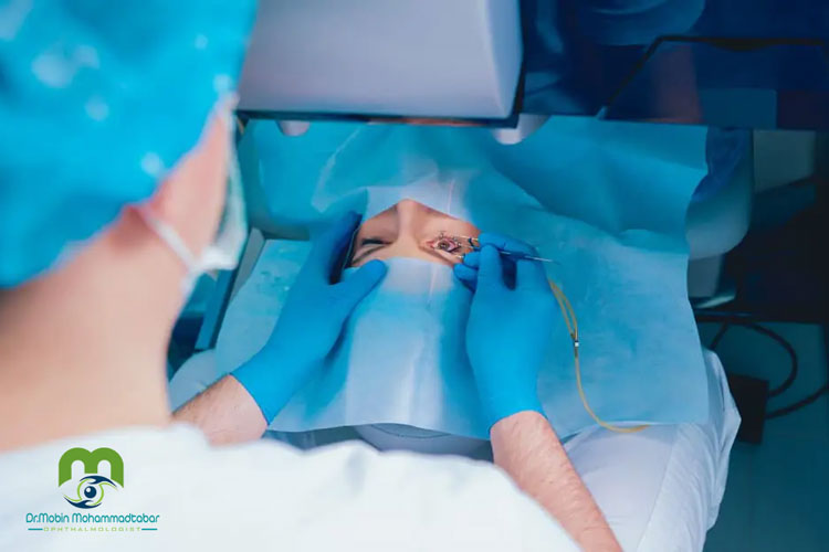 تفاوت عمل لیزیک با لازک