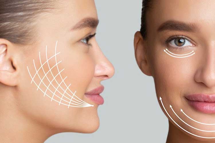 کاربردهای بوتاکس