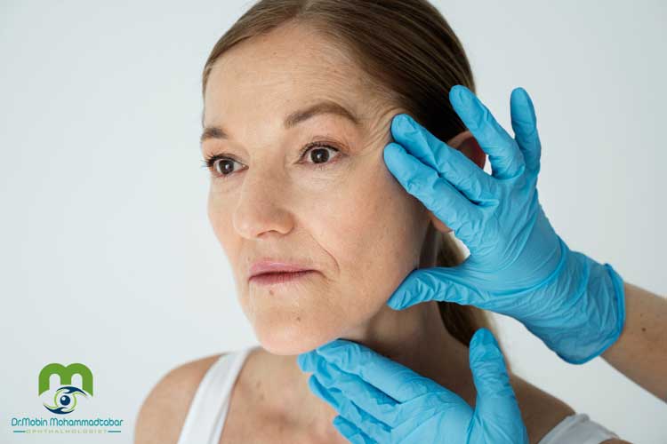 سن مناسب لیفت شقیقه اندوسکوپیک