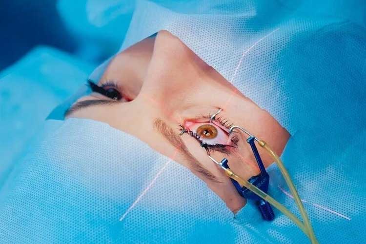 تفاوت فمتو اسمایل و فمتو لیزیک