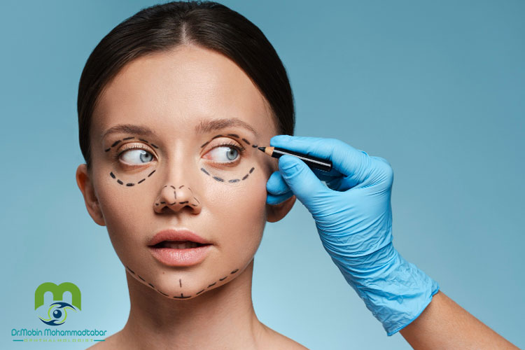 علت کوچک شدن چشم بعد از بلفاروپلاستی