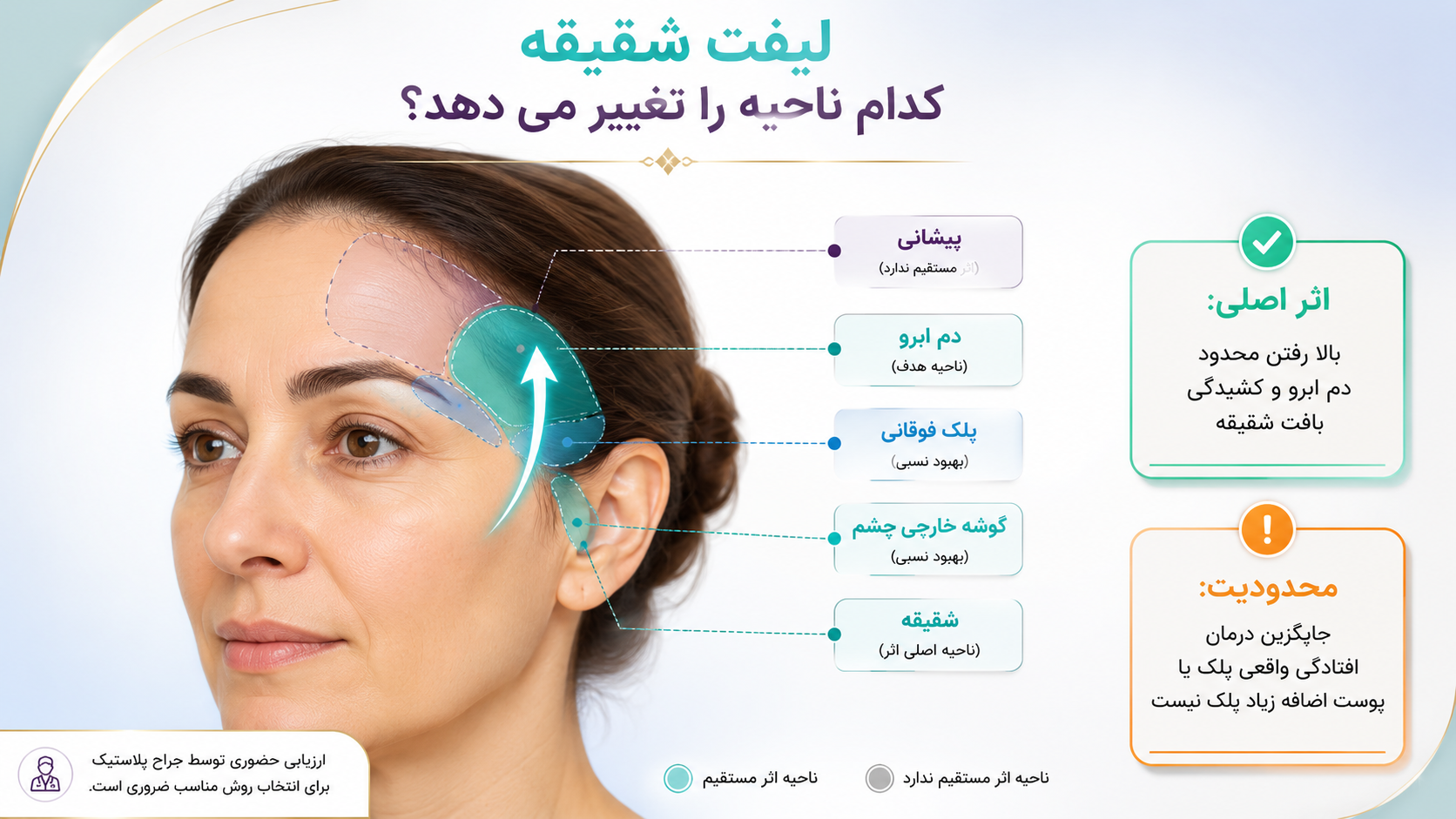 محدوده اثر لیفت شقیقه